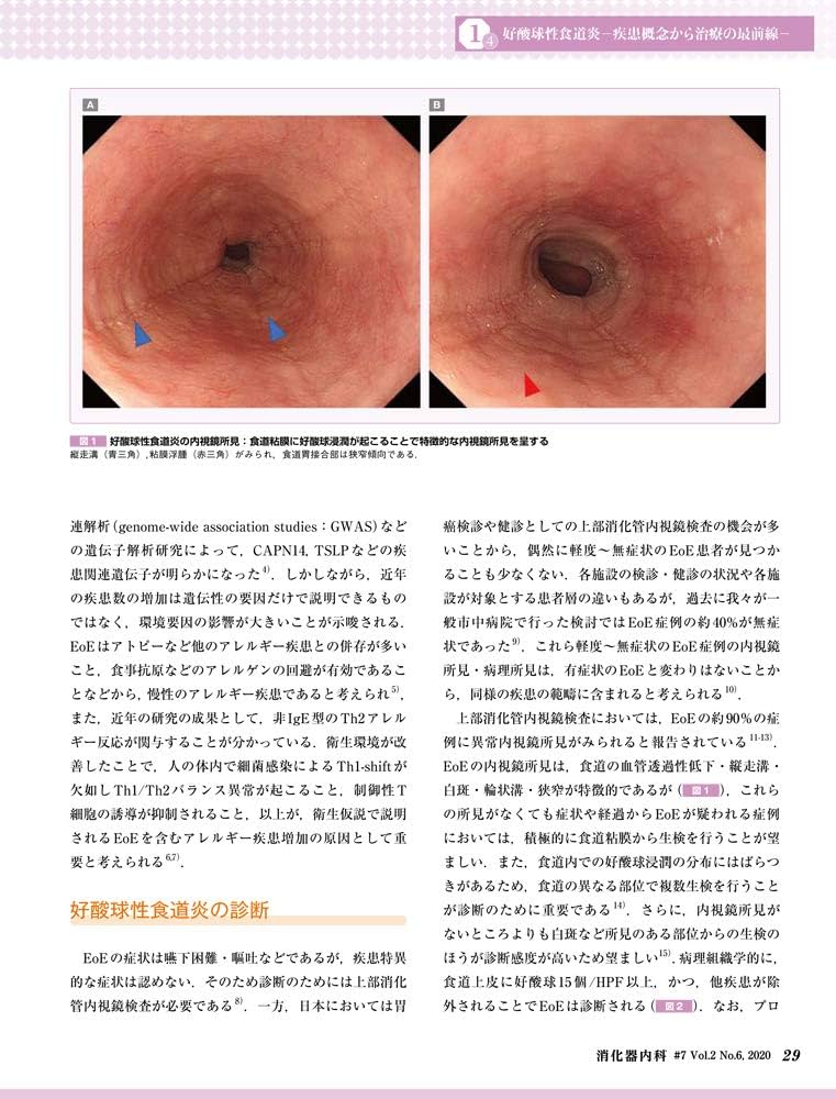 消化器内科 ♯８（Ｖｏｌ．２　Ｎｏ．７　２/医学出版（単行本） 消化器内科 ♯8（Vol．2 No．7 2/医学出版（単行本）の